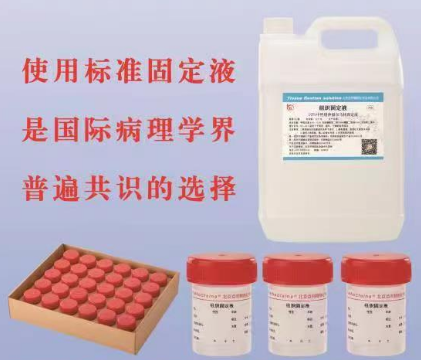 组织固定液 中性福尔马林固定液